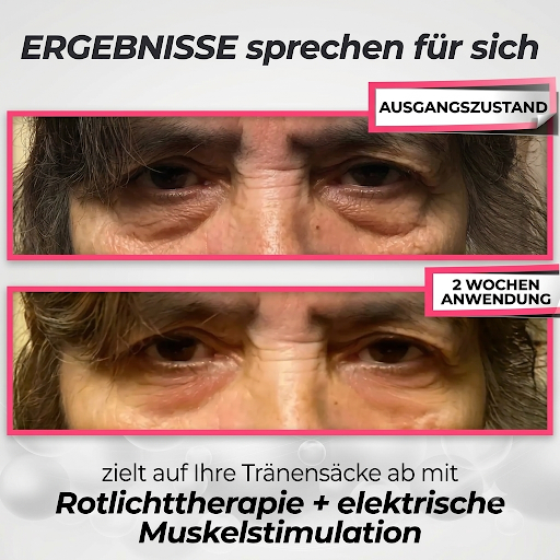 LumièreEyes® 2-in-1
