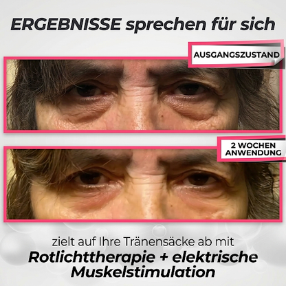LumièreEyes® 2-in-1