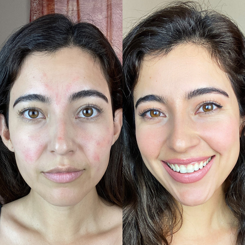 LueurMask® LED Anti-Aging Therapie