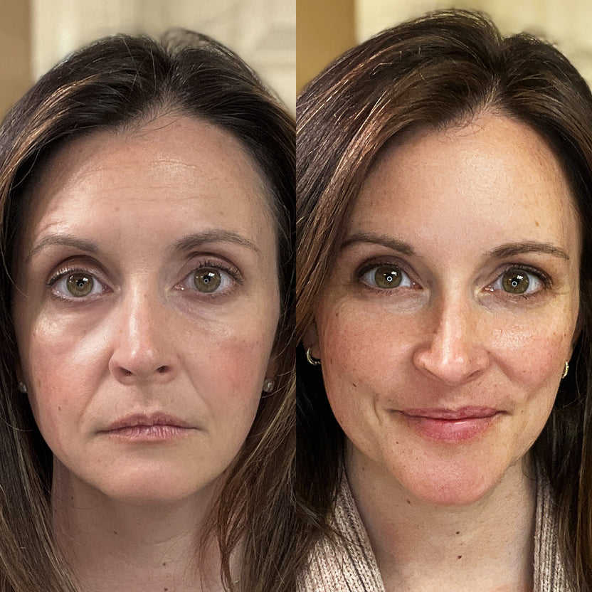ÈclatWand 4-in-1 Anti-Aging Lichttherapie