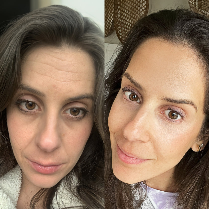 ÈclatWand 4-in-1 Anti-Aging Lichttherapie