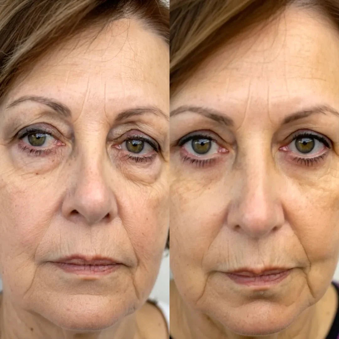 LumièreEyes® 2-in-1