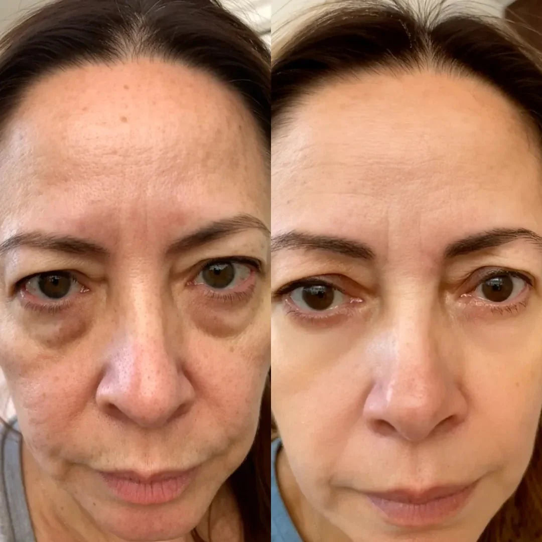 LumièreEyes® 2-in-1