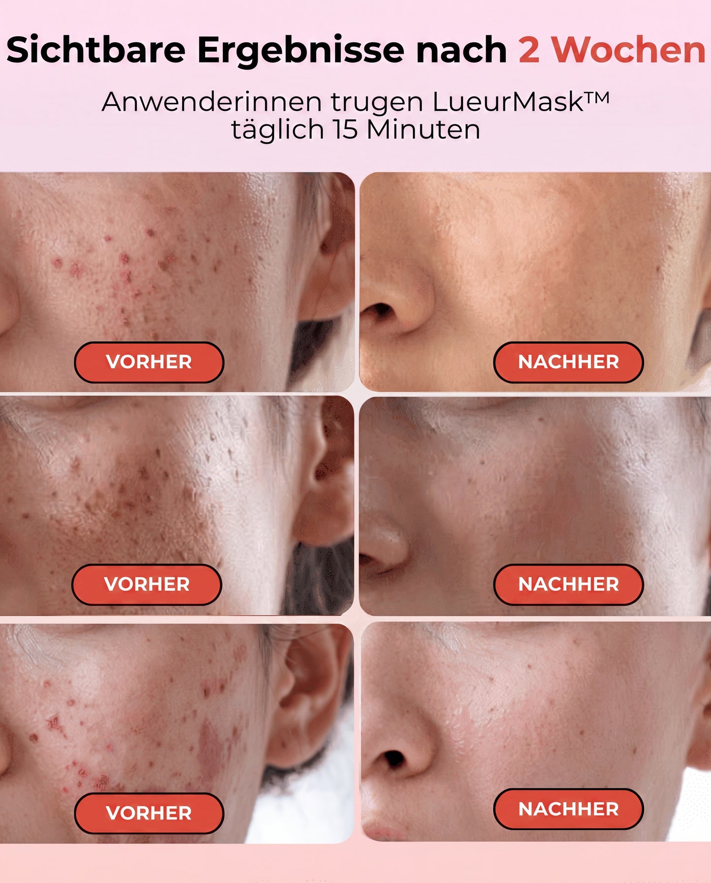 LueurMask® LED Anti-Aging Therapie